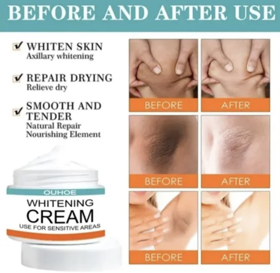 Sensitive Area Whitening Cream for Private Parts, Underarms, Inner Thighs, and Dark Spot Lightening(30ml)