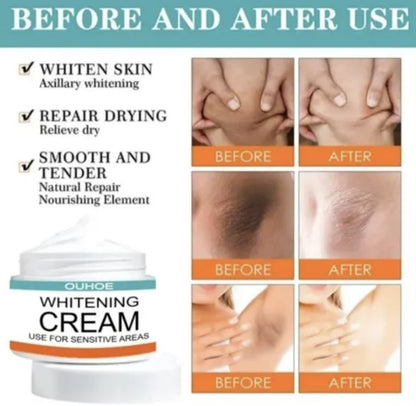 Sensitive Area Whitening Cream for Private Parts, Underarms, Inner Thighs, and Dark Spot Lightening(30ml)
